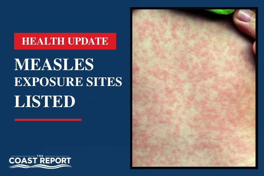 Coast Report graphic about measles exposure sites, showing a close-up of a red skin rash.